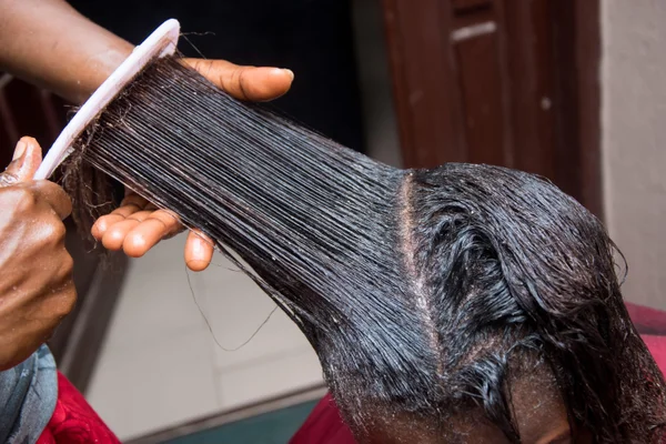 Hair Loss Image
